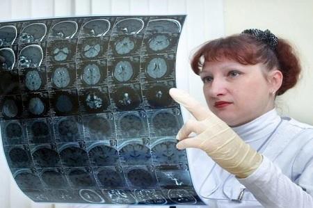 أطباء ألمان يكشفون خمس علامات تنذر بقرب الجلطة الدماغية