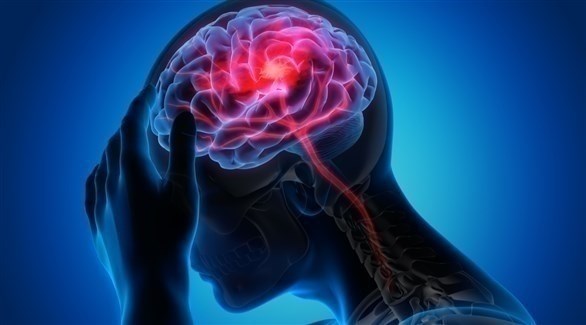 دراسة تكشف ما يحدث قبل السكتة الدماغية