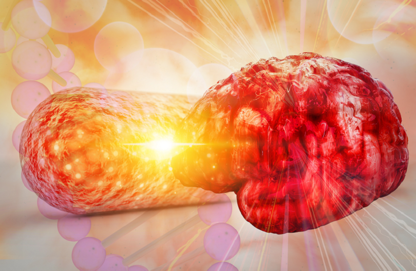 أمل جديد لمرضى السكتات الدماغية المتكررة